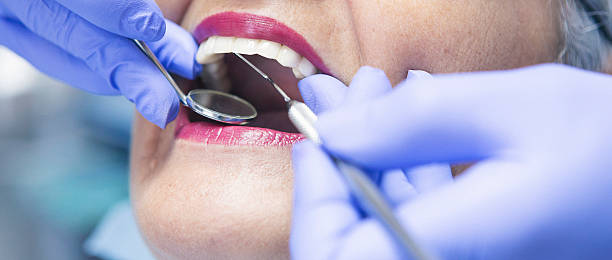 Best Emergency Dentist for Lost Fillings or Crowns in Milton Freewater, OR